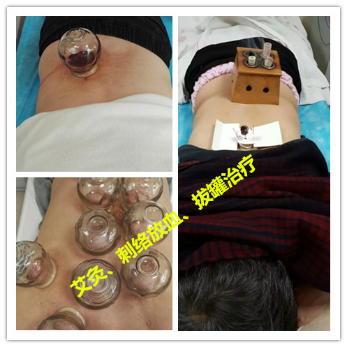 棰堣偐鑵拌吙鐥涙不鐤楃殑璇尯,鑵扮棝鍘诲尰闄㈣緭娑茬鐢ㄥ悧