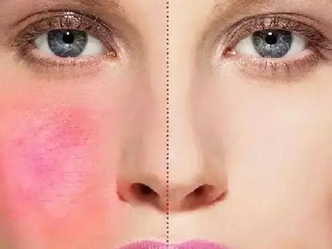 如何去除红痕,怎么去除红颜料