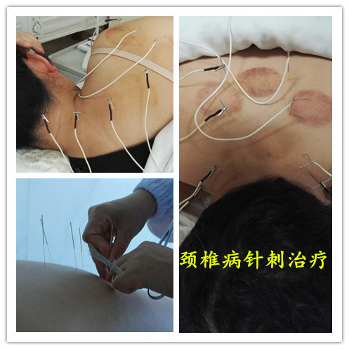 棰堣偐鑵拌吙鐥涙不鐤楃殑璇尯,鑵扮棝鍘诲尰闄㈣緭娑茬鐢ㄥ悧