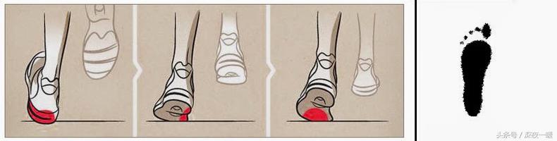 初跑者跑鞋怎么根据脚型选,如何选好一个合适的跑步鞋