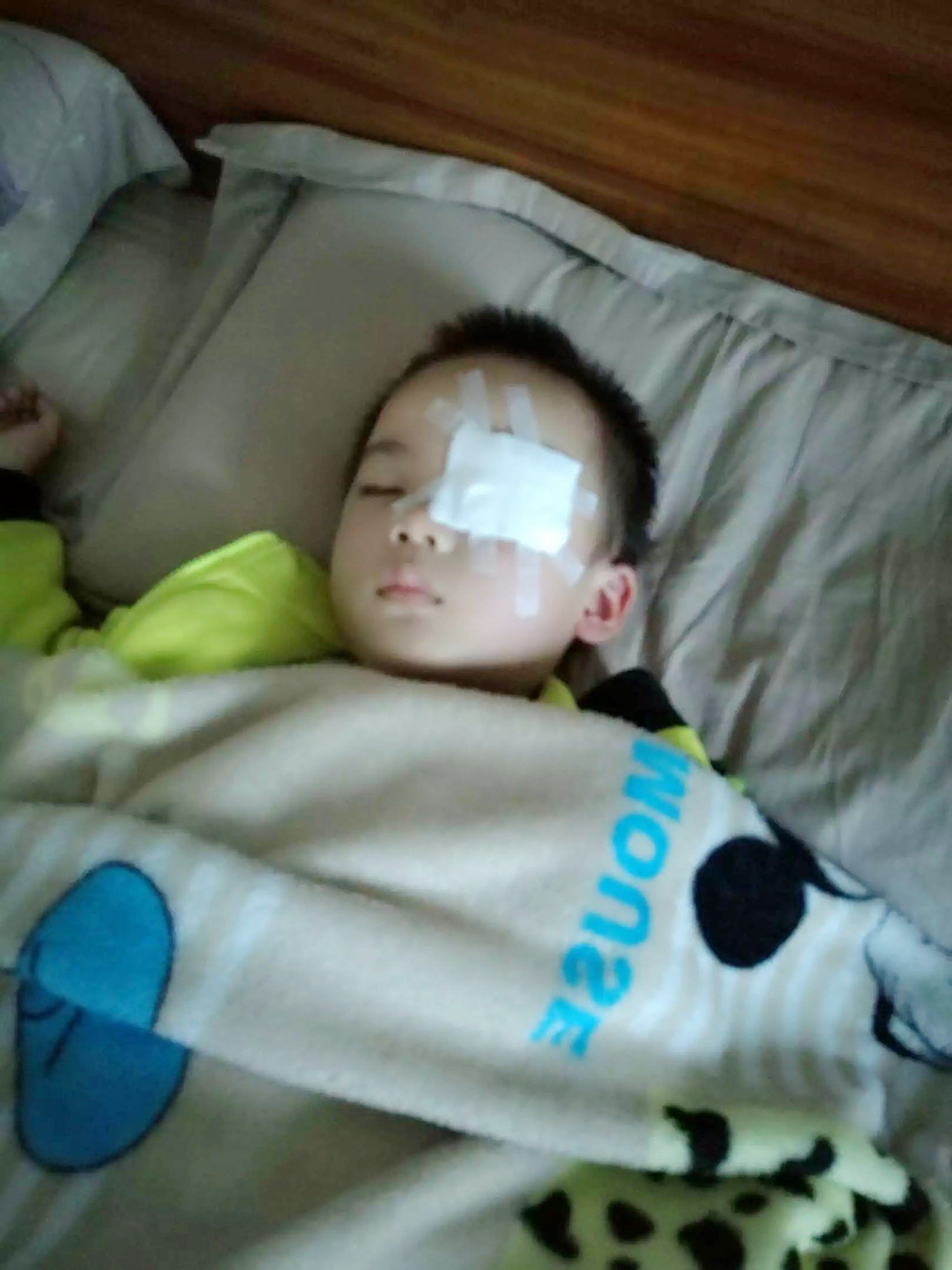 中药摆平霰粒肿经验,孩子得霰粒肿中医怎样调理