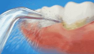 牙齿黄又丑又尴尬,牙齿黄笑的难看怎么办