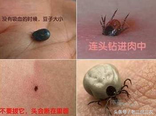 如果脏到长了这个东西，不管是城里还是农村人，都注定讨不到老婆