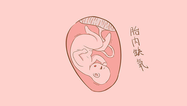 怀孕后期因为忽略了这件事,竟然差点造成胎儿窒息!