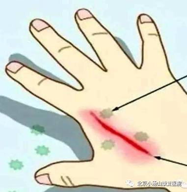 皮肤病的医疗科普口播视频,红蓝光治疗仪能治疗什么病