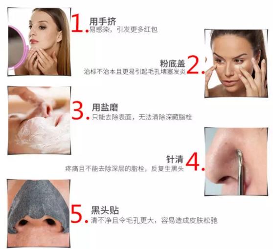 怎样去鼻子黑头最快最有效的方法,脸上黑头怎么去除最有效方法