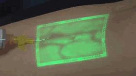 这个黑科技能照亮你的血管，让护士好好地给你扎针！