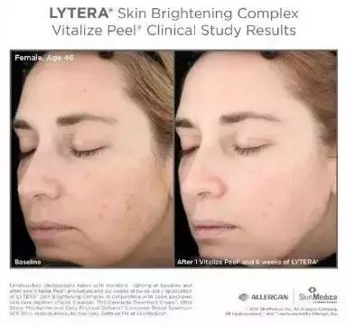 推荐一款最好的美白产品,推荐一款性价比高的美白产品