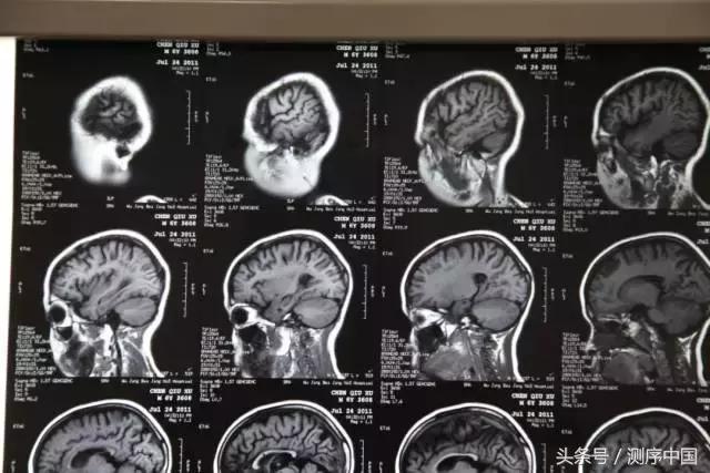 余永国儿科学博士,余永国教授