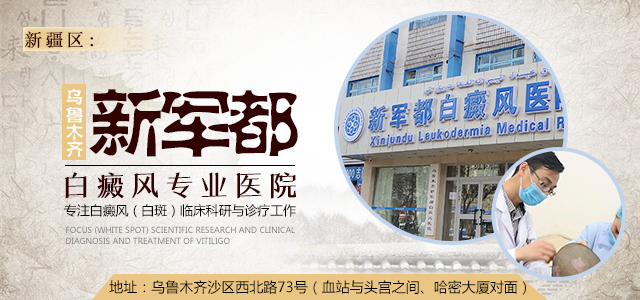 治疗白癜风时务必重视这几大事项,治疗白癜风一定要调整心态