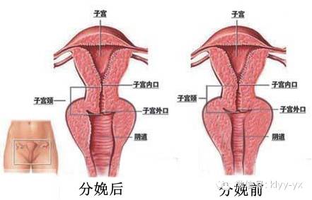 二胎后松弛怎么办,二胎后松弛了