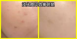 夜间护肤的正确步骤睡眠面膜,洗脸10分钟护肤一小时