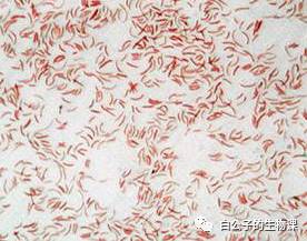 300倍显微镜能观察什么,什么东西可以通过显微镜来观察