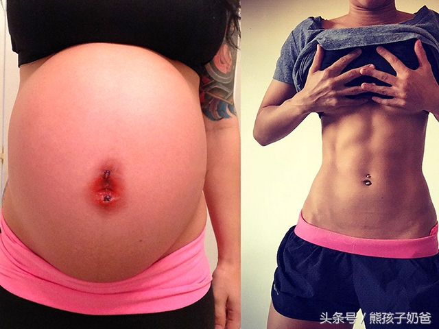 保孩子还是保大人好,保孩子还是保子宫