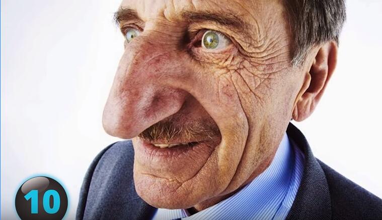 他们才是真正的超人，再大的挫折都挫不到他们，头不全又怎样