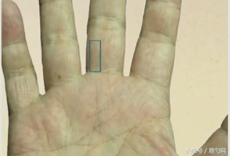 手掌大拇指下方肉发青色,手掌颜色偏青是什么原因