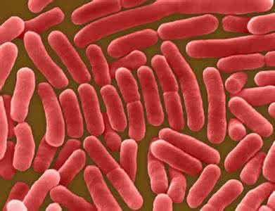 美国历史上的大瘟疫,美国发源的传染病