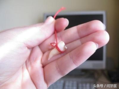 拔牙后出血不止是怎么回事,拔牙后出血不止引起死亡