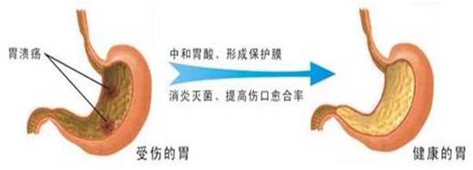 抽烟胃隐隐作痛,胃隐隐的痛跟吸烟有关系吗