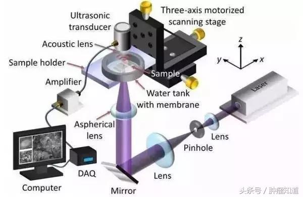 害怕乳腺癌切不净会复发?!新技术帮你杜绝复发风险!