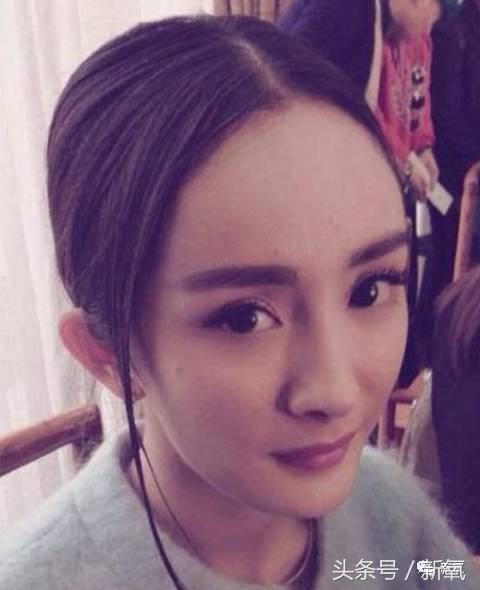 杨幂发际线还会回归吗,杨幂发际线秃到后脑勺