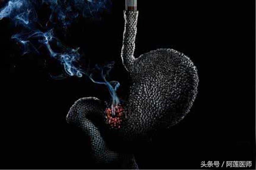 戒烟应该循序渐进还是一次戒断,递减法戒烟正确方法