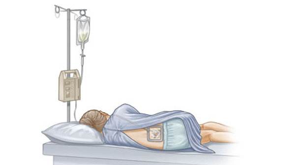 顺产好还是剖宫产好呀,顺产剖宫产利弊