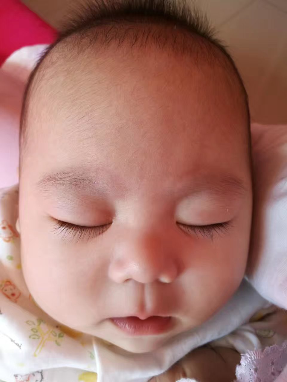 宝宝湿疹反复怎么办教你一招去除,宝宝湿疹反复怎么消除又快又好