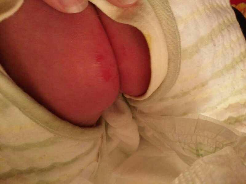 宝宝红屁股育婴师处理方法,新手妈妈红屁股怎么办