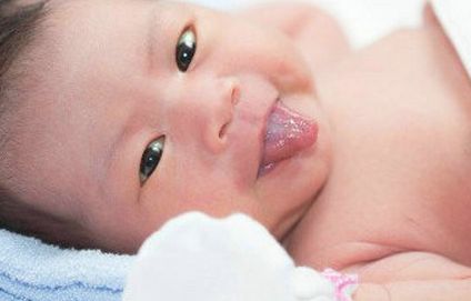 宝宝吃母乳舌苔黄是怎么回事,母乳宝宝舌苔白厚需要清理吗