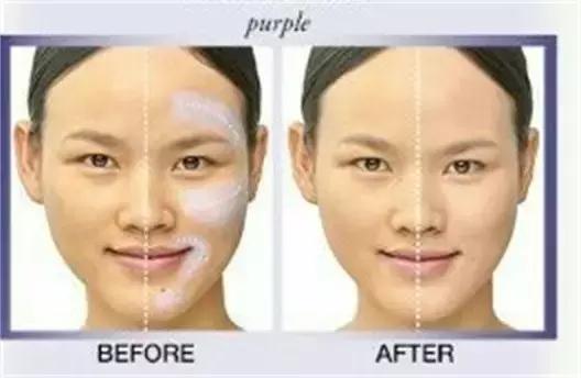 黑眼圈有痘痘怎么治,女人有黑眼圈