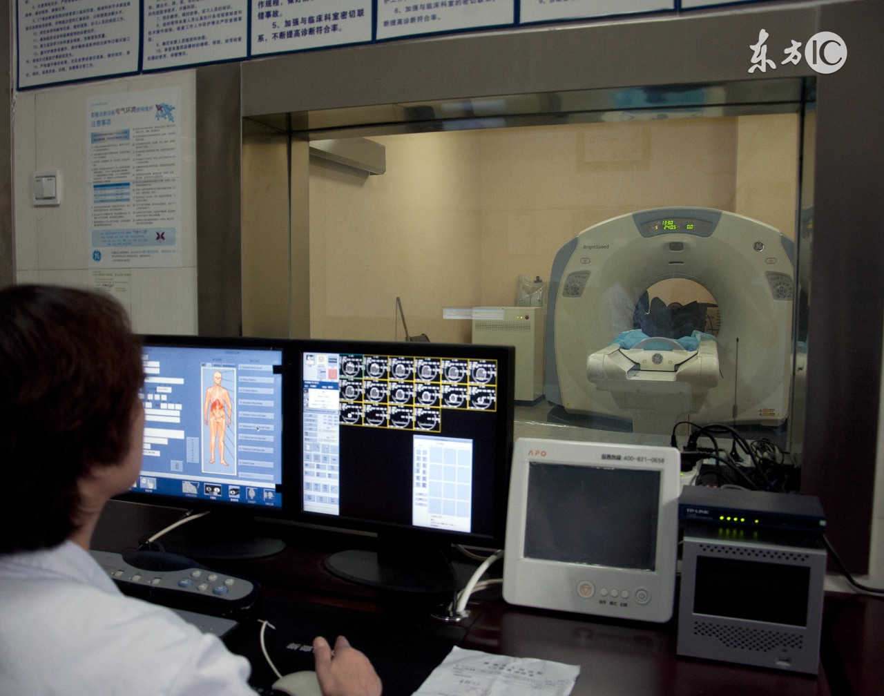 谁说顺产好的？我肠子都悔青了，后遗症多的真不如剖腹产