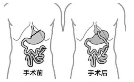 备一把尺，量一量你与死神的距离