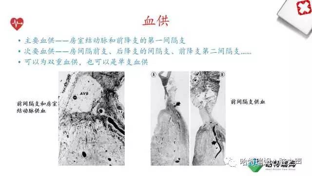 「心声」从机制到临床，一起认识左束支阻滞！