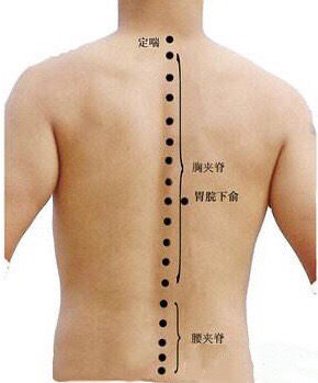 腰椎间盘突出反反复复腰痛怎么办,腰肌劳损腰疼和腰椎间盘突出