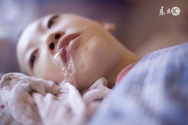 头痛型癫痫,头痛型癫痫有什么症状