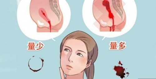 节育环如果不取有什么危害,节育环残留体内无影响是真的吗