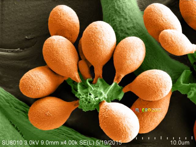 显微镜奇妙世界,显微镜下的奇妙世界视频