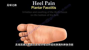 足跟痛最常见病因,足跟痛警惕四种疾病