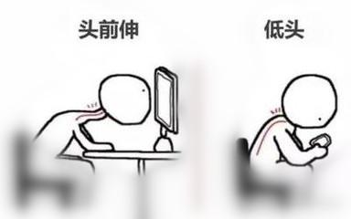 一抬头脊椎疼怎么缓解,抬头颈椎疼如何缓解