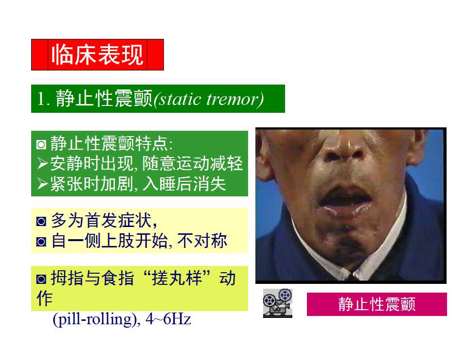 多图详解帕金森及运动障碍性疾病|关于帕金森最全的一个课件