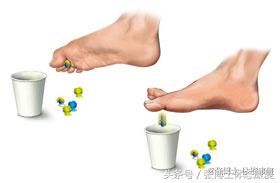 怎么站立可以改善足弓塌陷,如何站立练背