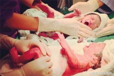 产妇剖腹产一个多月刀疤突然崩裂,宝妈剖腹产二十多天后刀口有点疼