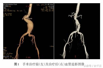 晚上牙疼去医院急诊科可以吗,牙疼通宵熬夜住院进了icu