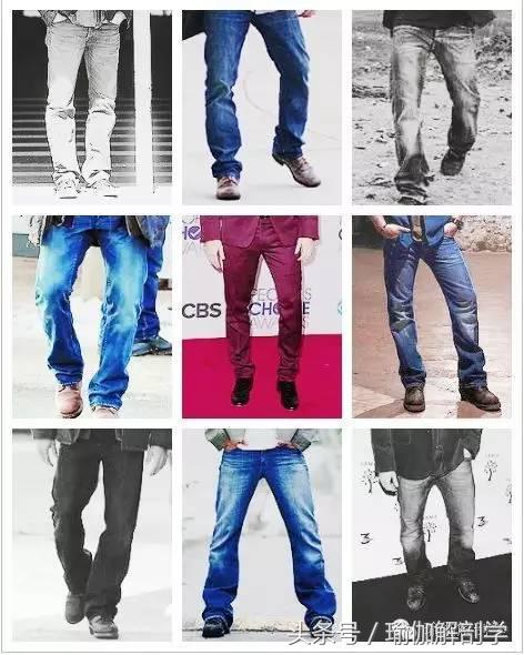 什么是o型腿如何矫正,成年人如何矫正o型腿