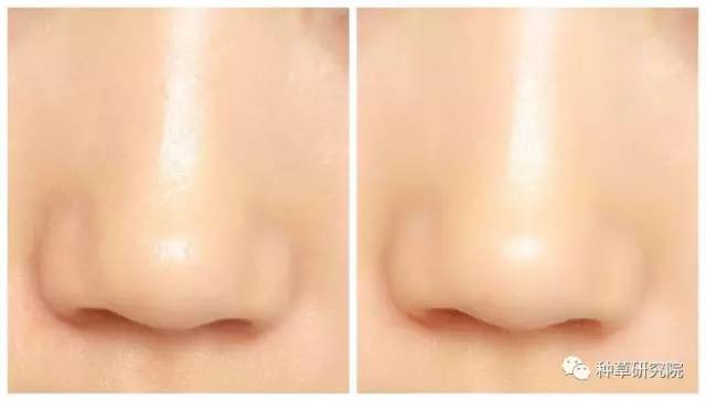 怎么让皮肤光滑如蛋清,怎样能让皮肤变得和鸡蛋一样光滑