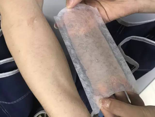 最好用的脱毛产品推荐,推荐一款脱毛产品