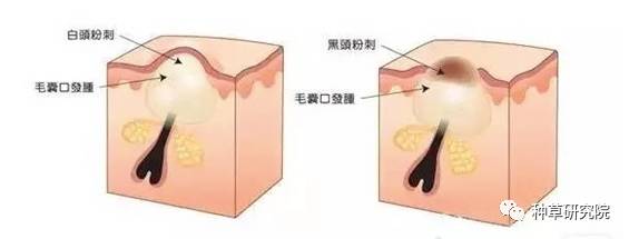 简单快速让皮肤水嫩的方式,怎么让皮肤像剥壳鸡蛋一样光滑