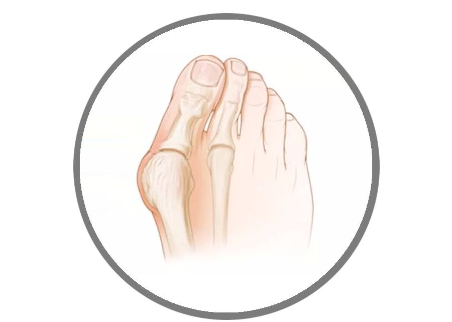 适合自己的脚的鞋才是最好的鞋,怎么挑选一双不磨脚的鞋