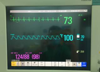 围手术期个案护理比赛优秀案例ppt,术后镇痛的规范化管理ppt